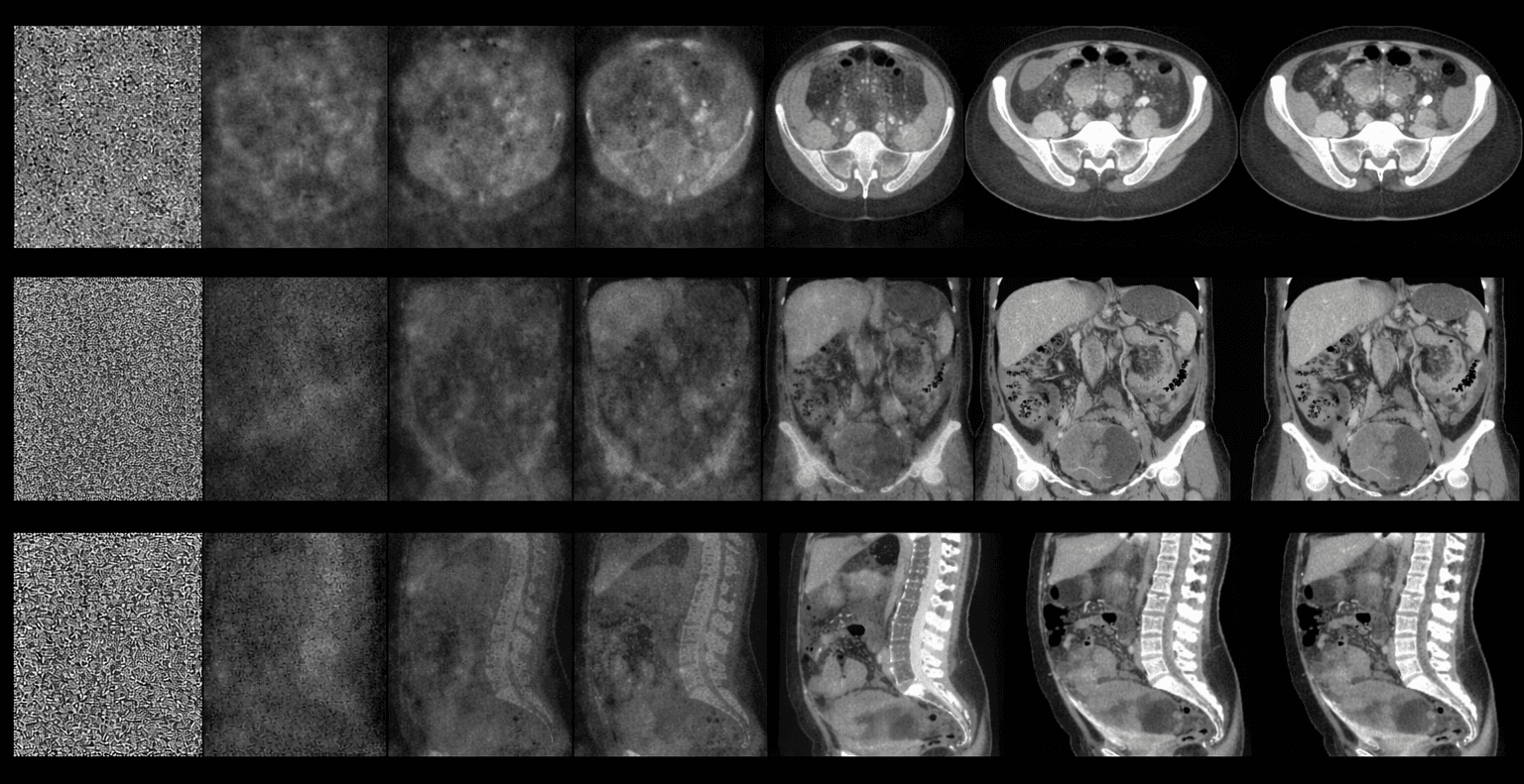 Generative CT synthesis